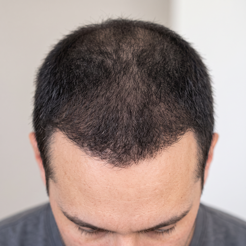 After