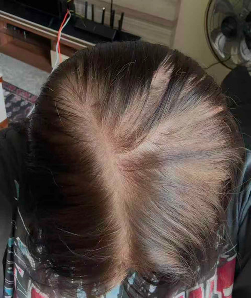 Before